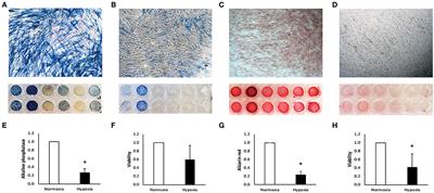 The Influence of Pro-Inflammatory Factors on Sclerostin and Dickkopf-1 Production in Human Dental Pulp Cells Under Hypoxic Conditions